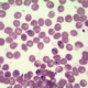 Hundemalaria Babesiose-rote Blutkörperchen